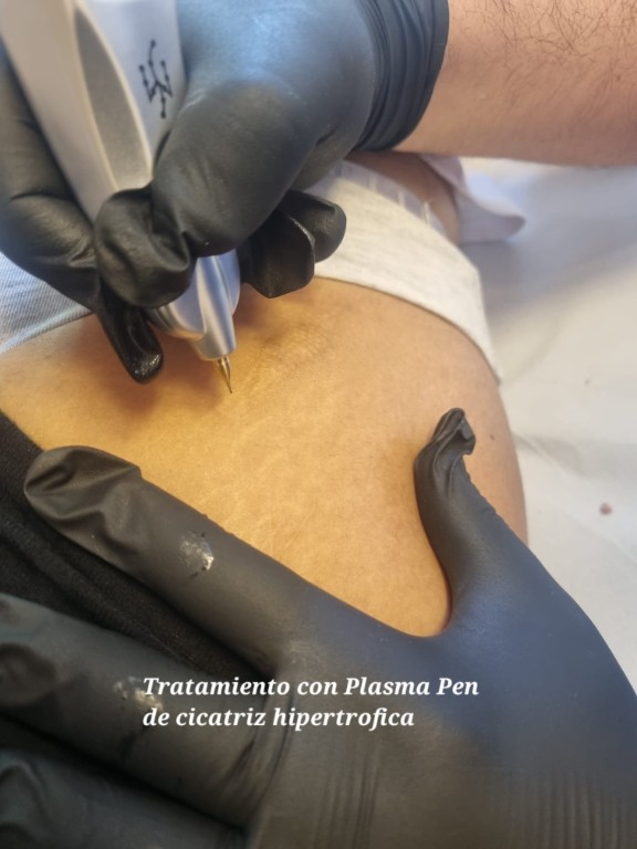 Imagen Galería: 