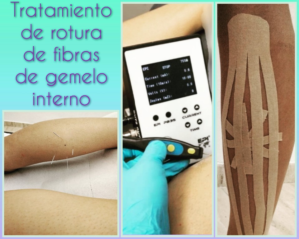 Imagen Galería: 