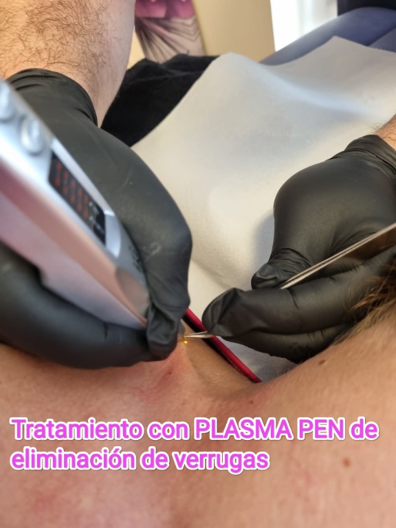 Imagen Galería: 