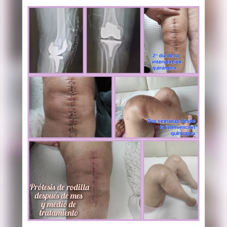 Imagen Galería: 
